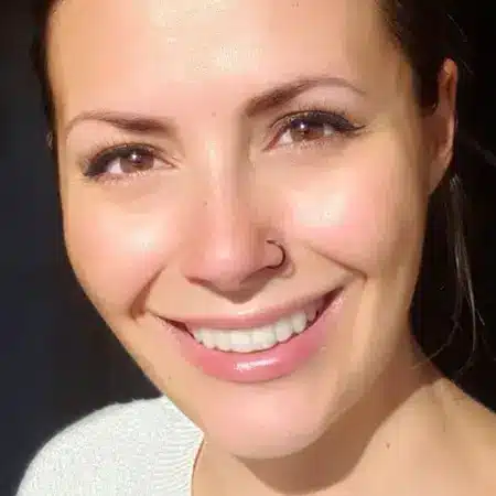 Invisalign 3 01 after