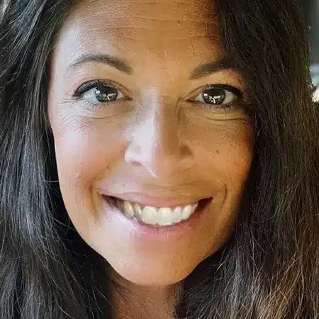 Invisalign 8 04 before